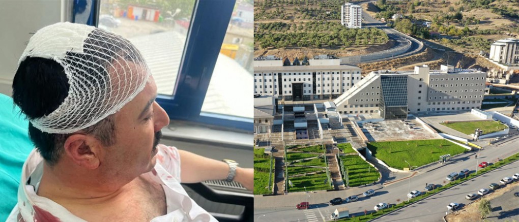 KAHRAMANMARAŞ’TA BELEDİYE BAŞKAN YARDIMCISINA SALDIRI