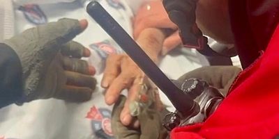 KAHRAMANMARAŞ’TA PARMAĞINA SIKIŞAN YÜZÜK İTFAİYE EKİPLERİNCE ÇIKARILDI